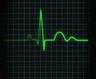 ecg